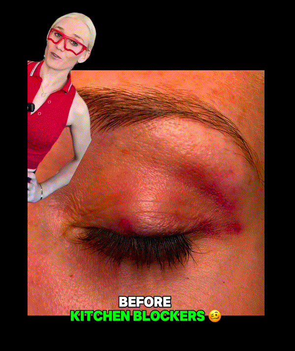 Kitchen Blocker Lens-Free Pickleball Eye Protection - Image 4